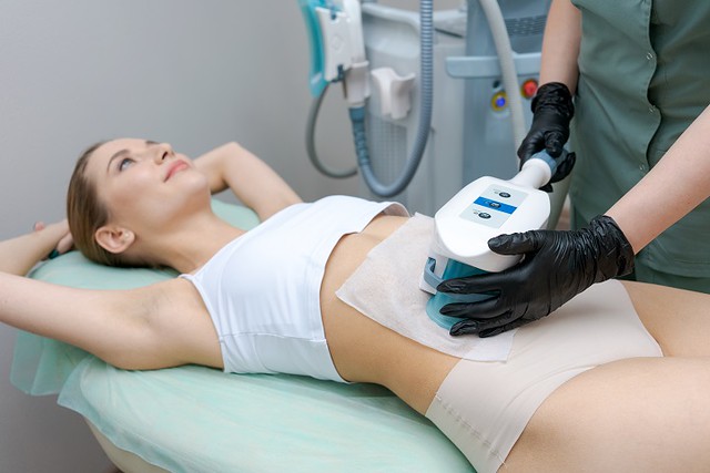 Cryolipolysis Treatment: A Revolutionary Approach to Fat Reduction